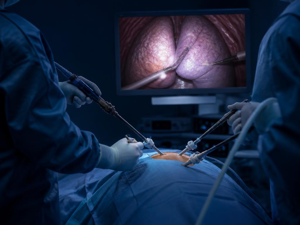 Equipe realizando cirurgia torácica minimamente invasiva por vídeo